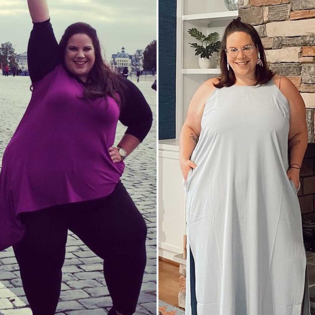 Weight Loss Surgery Whitney Thore's Incredible Transformation