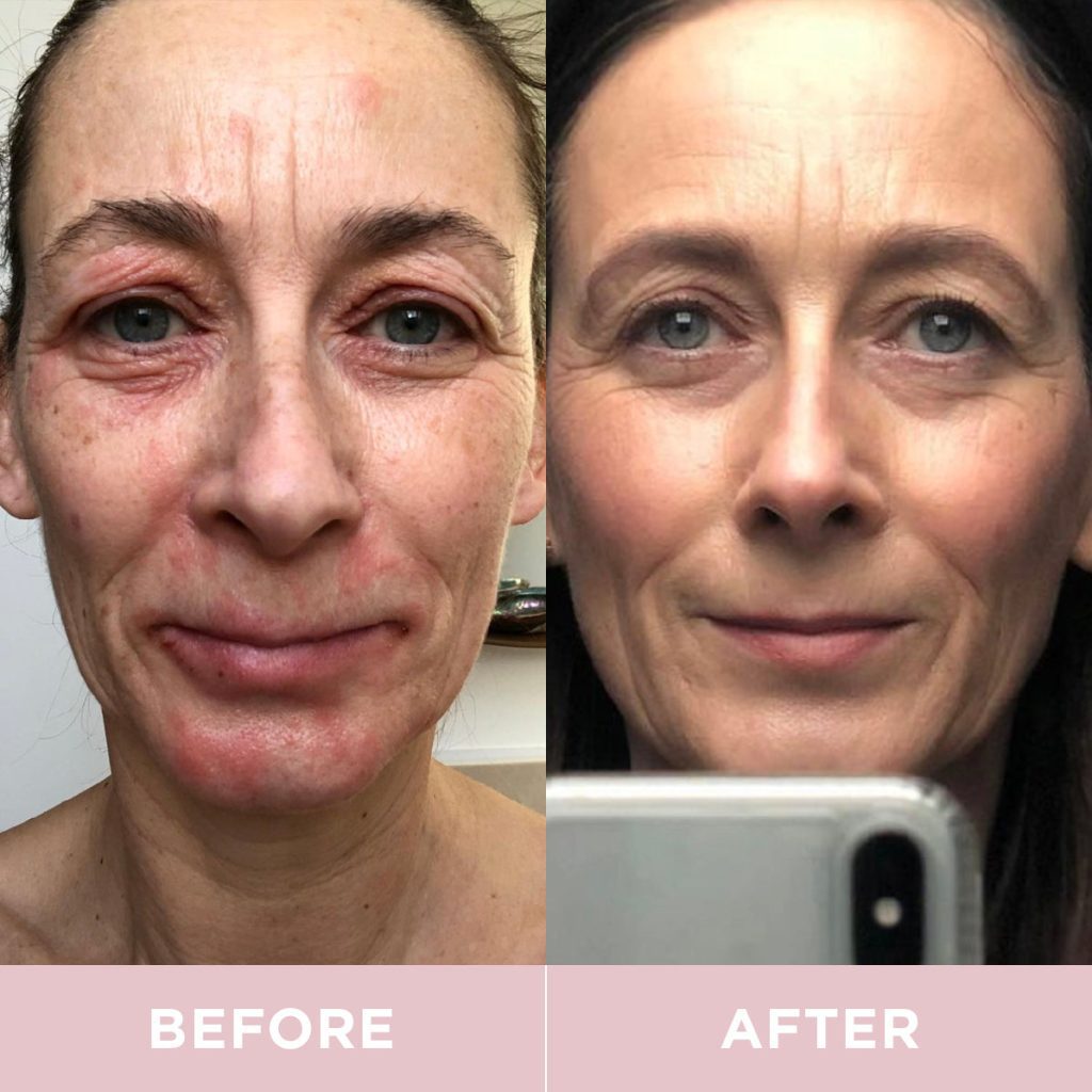 Collagen Supplements